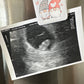 Gender Reveal Trinket Box